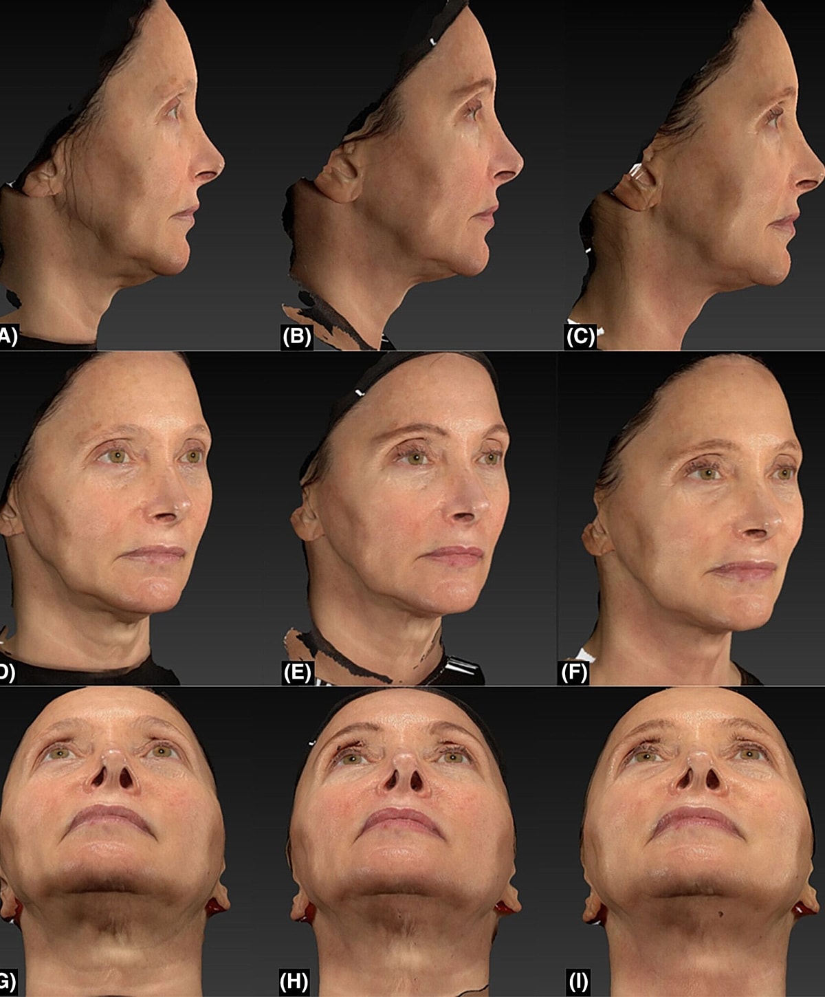 Facial scans from multiple angles and perspectives.