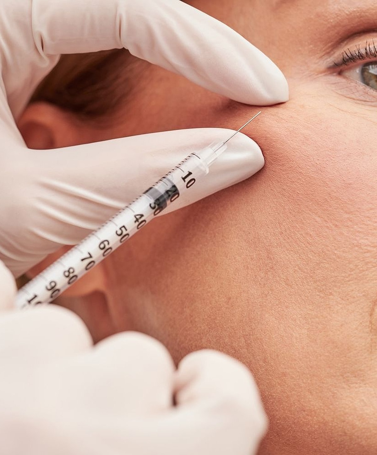 Injection procedure near the eye area.