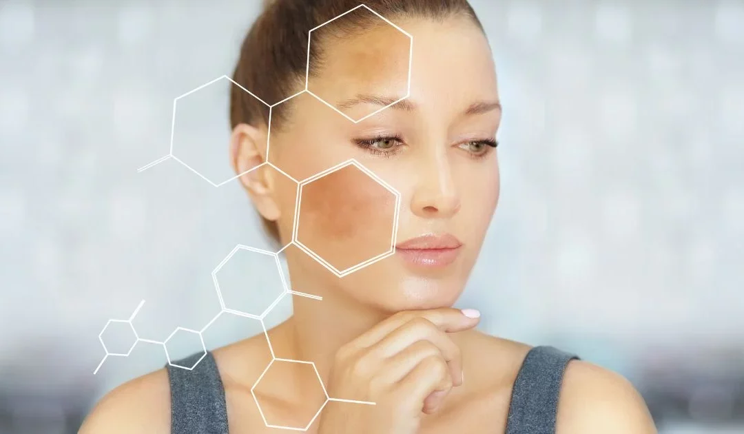 Can This Skin Rejuvenation Treatment Help With Hyperpigmentation?