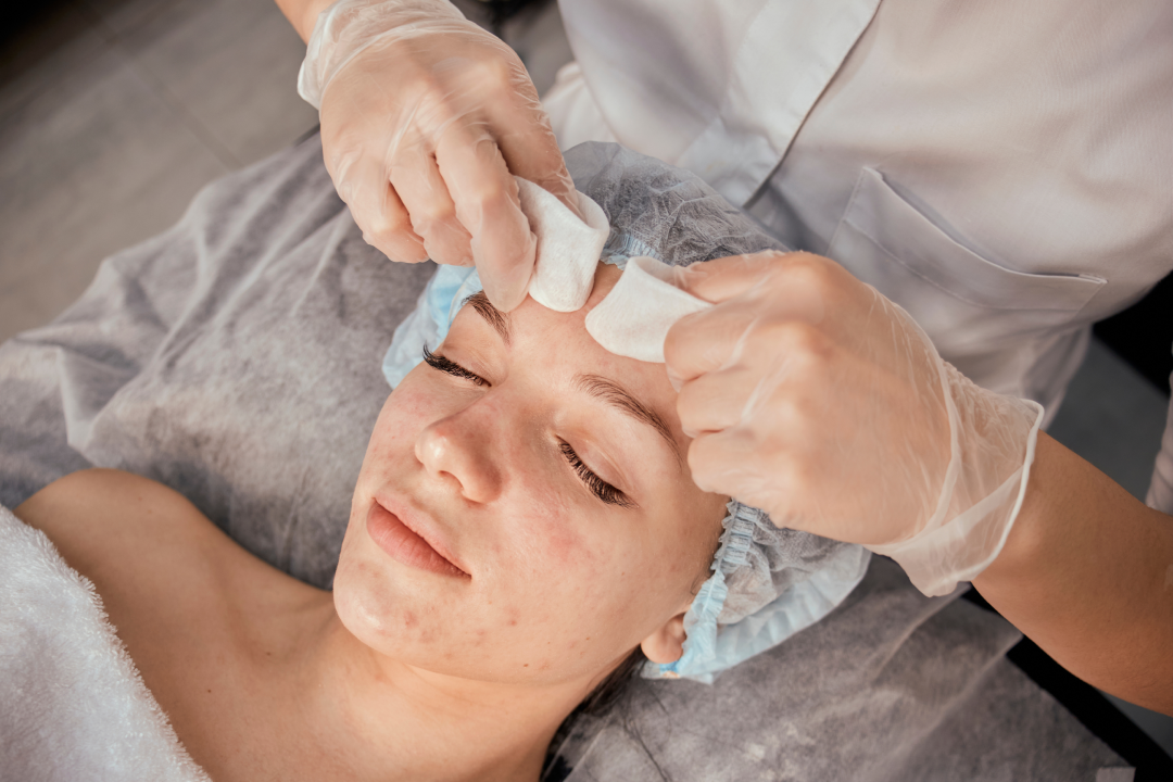 A patient undergoing preparation for an EzGel session with a specialist applying cleansing pads.