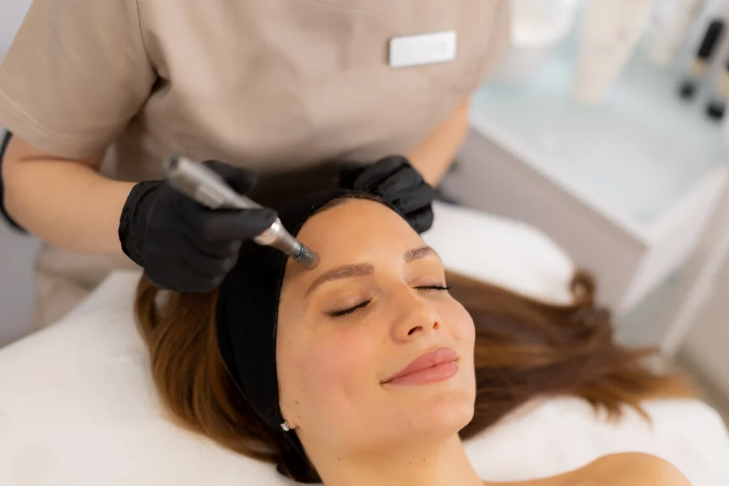 Practitioner performs a microneedling treatment on a patient's forehead while the patient rests with eyes closed.