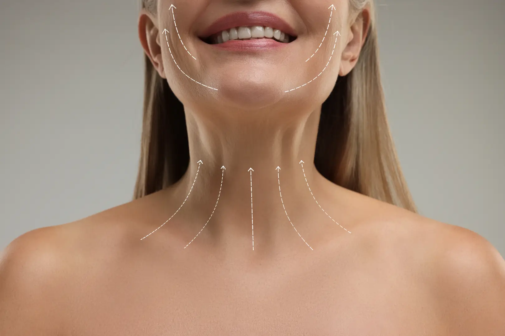 Close-up of a woman's neck and lower face with white dashed arrows along the jawline and neck.