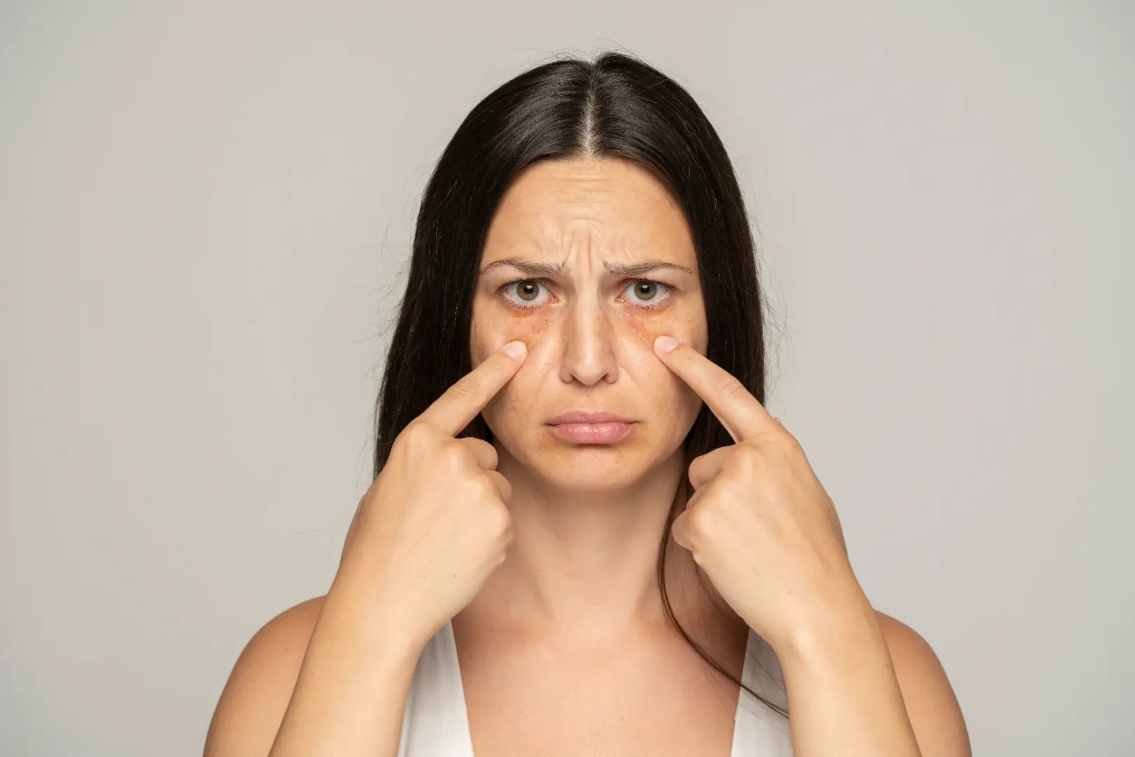 Woman points with both index fingers to visible darkness beneath her eyes against a gray background.